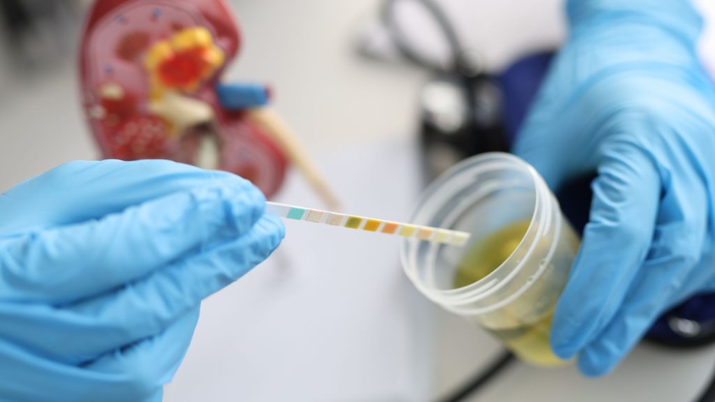 Sugar in Urine